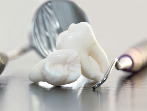 oral-surgery-fort-worth